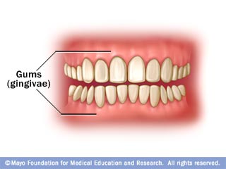 gums (gingivae) Gums (gingivae)