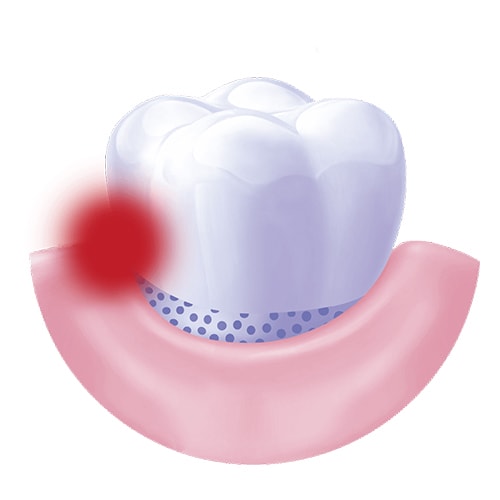 sensitivity teeth pain